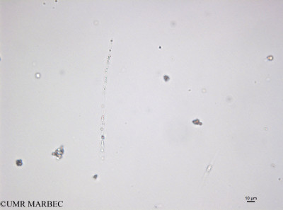 phyto/Bizerte/bizerte_bay/RISCO April 2014/Leptocylindrus minimus (141216_001_ovl)(copy)_thumb.jpg